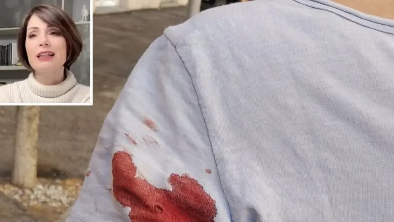 Roma Prati: Arrestato il Presunto Cecchino Dopo Due Sparature