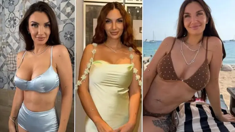 Elettra Lamborghini: il viso gonfio e i cambiamenti d'umore dopo un trattamento estetico