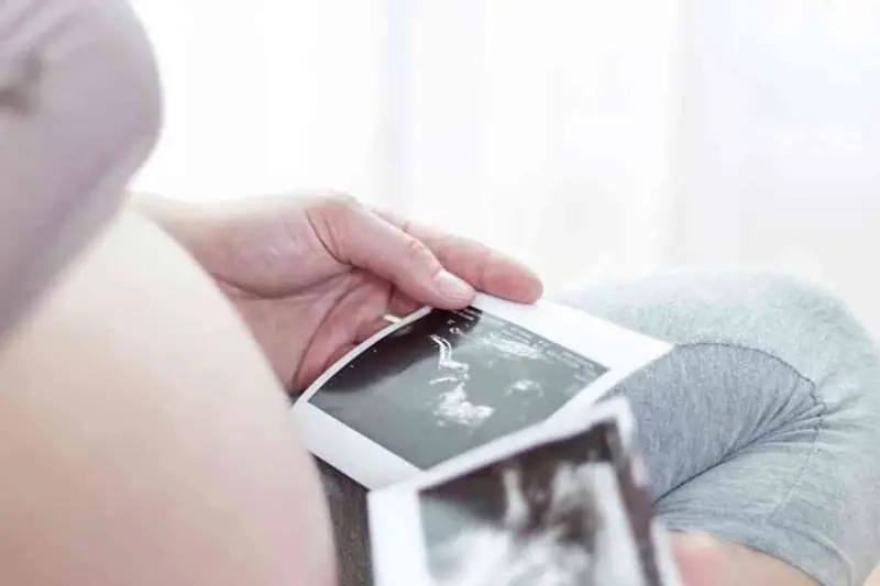 La ‘Madre Fuorilegge’: 25 Voli per un Figlio, la Battaglia per la PMA in Italia